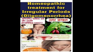 Irregular Menses Homoeopathic Medicine//Abroma Radix //अनियमित मासिक धर्म//Leucorrhea Problem//Pain.