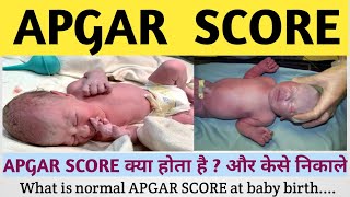 WHAT IS APGAR SCORE || HOW TO CALCULATE APGAR SCORE || NEONATAL SCORE || APGAR SCORE HINDI ME