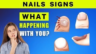 WARNING: TOP 10 Nails SIGNS of HEALTH PROBLEM