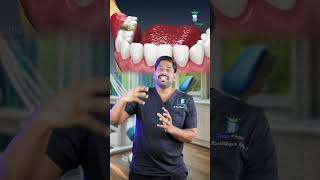 பல்லின் வேர் துந்து விடுமா? - Calcification of the Canal | Dr.Karthikeyan | Denta Kings