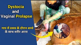 How to handle dystocia and vaginal prolapse ||। कठिन प्रसव ।।