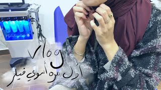 milkyway11000 : vlog أول مره استخدم فيلر لوجهي