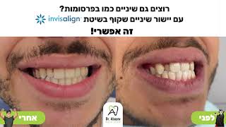 יישור שיניים שקוף אינויזליין invisalign המקורי במרפאת שיניים דר אבייב