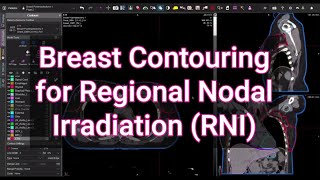 Breast Contouring Regional Nodes... a Walkthrough