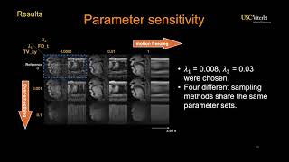 Ziwei Zhao | Improved 3D real-time MRI of speech production