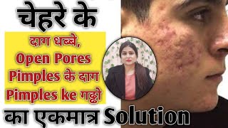 How To Remove Acne Scars, Open Pores, blemishes at home | चेहरे के दाग धब्बे बहुत आसानी से हटाओ ।