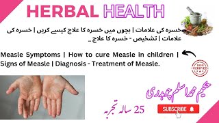 Measle Symptoms | How to cure Measle in children | Signs of Measle | Diagnosis - Treatment of Measle