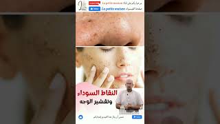 النقاط السوداء وتقشير الوجه الدكتور عماد ميزاب Docteur Imad Mizab