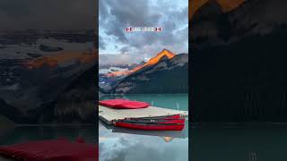 Living My Best Life At Lake Louise tiktok shortstuff explores