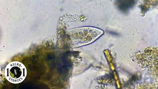 Paramecium caudatum feeding