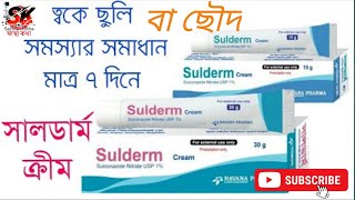 ছৌদ দূর করার ক্রিম । Sulderm cream uses | সালডার্ম ক্রিম | ছুলি রোগের চিকিৎসায়