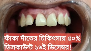 ফাঁকা দাঁতের চিকিৎসায় ৫০% ডিসকাউন্ট ১৬ই ডিসেম্বর উপলক্ষে! ১ দিনে ফাঁকা দাঁতের চিকিৎসা। Tech Dental