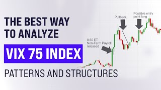 How to analyze vix 75 index  -  v75  -  volatility 75 index