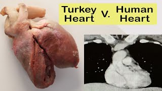 Don't throw away the turkey's heart on Thanksgiving.  Dissect it, and here's how!