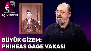 Büyük Tıbbi Gizem: "Phineas Gage Vakası" | Sinan Canan İle Açık Beyin