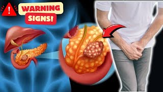 Warning Signs of Pancreatic Cancer | Pancreatic Cancer Symptoms