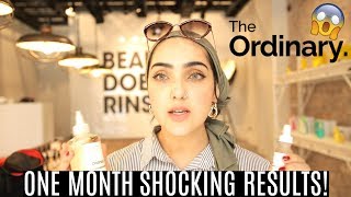 *OMG*I Tried THE ORDINARY SKINCARE For ONE MONTH! *SHOCKED* ~ Immy