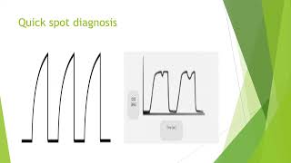 Capnography in Anaesthesia and Critical Care