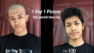 Bald to 100 day without haircut, hair growth Timeslap.