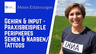 Meine Erfahrung - Warum ein gutes peripheres Sehen und rehabilitierte Narbengebiete wichtig sind?