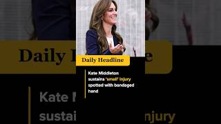 Kate Middleton sustains ‘small’ injury #shorts #viral