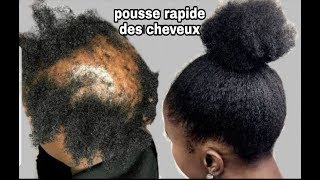 Vos cheveux vont pousser a la folie!