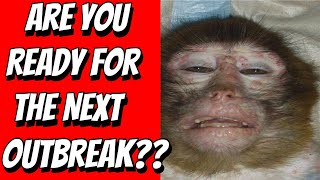 Monkeypox OUTBREAK. SHTF is here. Stock up Now. Food Shortage is Near. This could AFFECT Everyone.