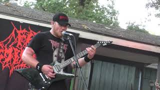 Fetal Embalment at Arkansas Death Fest