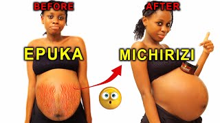 Jinsi ya Kuondoa MICHIRIZI KWA HARAKA | How to remove stretchmarks easily