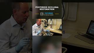 Posterior Occlusal Restoration Mini Tip | Dental Online Training #shorts