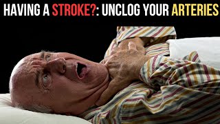 Unclog Arteries: Stroke Prevention & Brain Health Tip