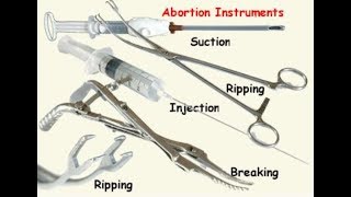 Commentary: Abortion IS Baby Killing!