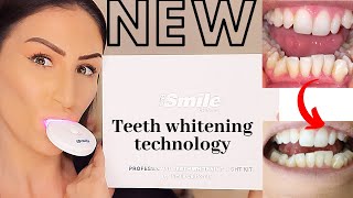 NEW AT-HOME TEETH WHITENING KIT with RED light for sensitive teeth - iSmile CALIFORNIA