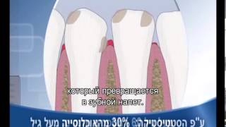 טיפול מחלות חניכיים במרפאת ד"ר ג'רי כהן +כתוביות ברוסית