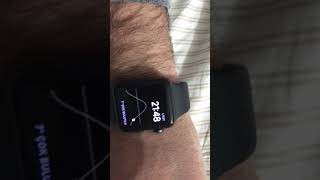 Apple Watch Kalp Ritmi ölçme ve Ekg çekme