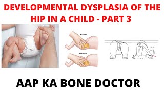 DEVELOPMENTAL DYSPLASIA OF THE HIP IN A CHILD - PART  -3,  EPISODE 24