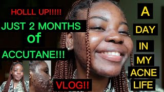 Week 8 Accutane Journey with my cystic acne | A Vlog!! A