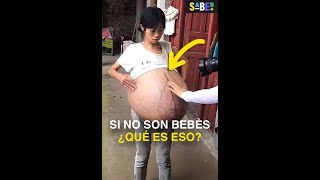 No era un bebé lo que estaba en su barriga 😰 #curiosidades