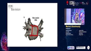 AF Ablation which approach for which patient   Dr   Mervat aboulmaaty