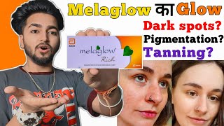 Does Melaglow Cream Really Works ? | Melaglow Rich Cream Review