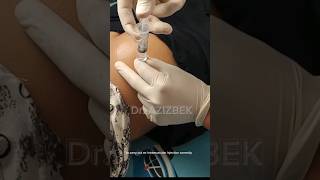 intramuscular injection into the buttock #doctor #intramuscularinjection #injection