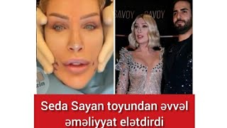 Seda Sayan "Toyundan əvvəl üzündə yenidən əməlliyyat etdirdi"( Buyurun videonu izləyin)