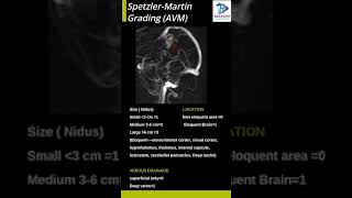 Spetzler-Martin Grading (AVM)