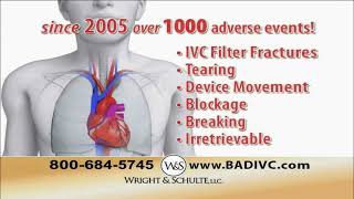 WRIGHT & SCHULTE LLC TV SPOT IVC FILTER IMPLANT ISPOT.TV