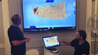 CEREC Primescan Model Phase Sequence & Tips - IDDA MiniBytes Tutorials