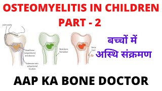 OSTEOMYELITIS IN CHILDREN - PART 2 - EPISODE 42