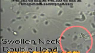 Double Head sperm, with Swollen Neck sperm video