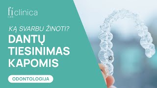 DANTŲ TIESINIMAS KAPOMIS. Ką svarbu žinoti? | Alvyda Žarovienė - Gydytoja Ortodontė | Fi Clinica