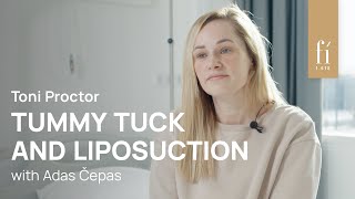 TUMMY TUCK AND LIPOSUCTION | Toni Proctor | Fi Clinica