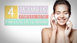 4 Mascarillas para el Acné que puedes hacer tú mismo